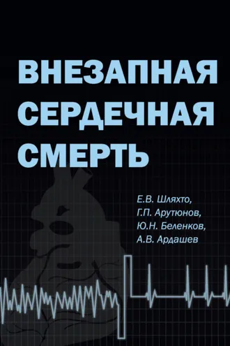 Обложка книги «Внезапная сердечная смерть»