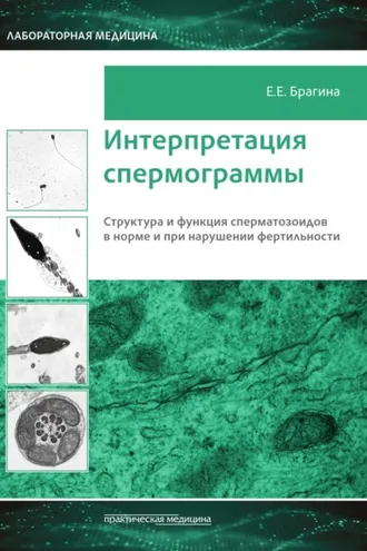 Обложка книги «Интерпретация спермограммы. Структура и функция сперматозоидов в норме и при нарушении фертильности»