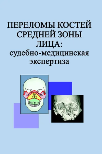 Обложка книги «Переломы костей средней зоны лица: судебно-медицинская экспертиза»