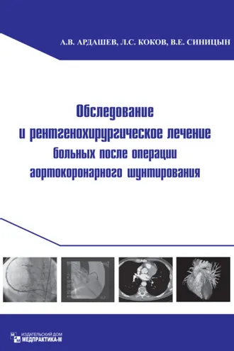 Обложка книги «Обследование и рентгенохирургическое лечение больных после операции аортокоронарного шунтирования»