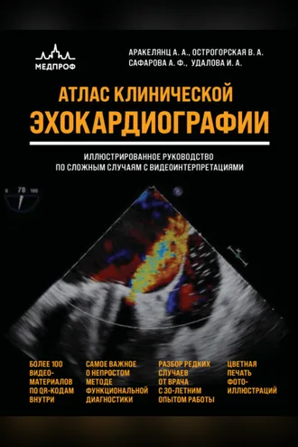 Обложка книги «Атлас ЭхоКГ. Иллюстрированное руководство по сложным случаям с видеоинтерпретациями»