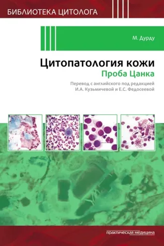 Обложка книги «Цитопатология кожи. Проба Цанка»