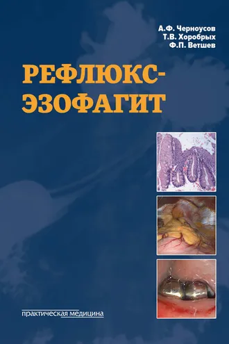 Обложка книги «Рефлюкс-эзофагит»