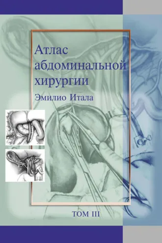 Обложка книги «Атлас абдоминальной хирургии. Том 3. Хирургия тонкой и толстой кишки, прямой кишки и анальной области»