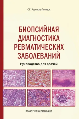 Обложка книги «Биопсийная диагностика ревматических заболеваний. Руководство для врачей»