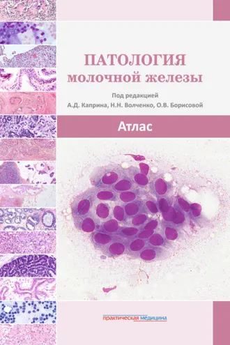 Обложка книги «Патология молочной железы. Атлас»