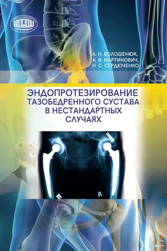 Обложка книги «Эндопротезирование тазобедренного сустава в нестандартных случаях»